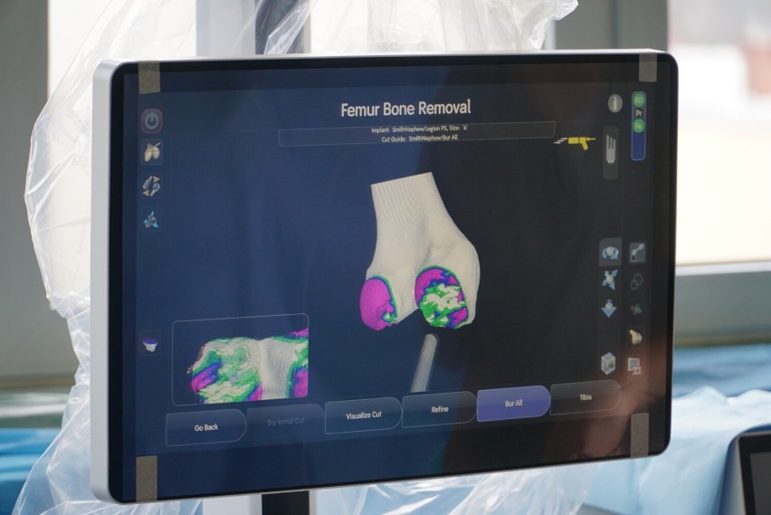 Robot ortopedyczny NAVIO jest już w bolesławieckim szpitalu. To jeden z najbardziej innowacyjnych sprzętów w Polsce