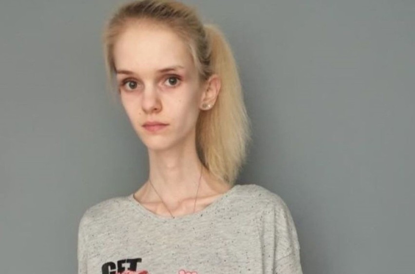 22-letnia Natalia Sykoś z Dobrodzienia cierpi na anoreksję....