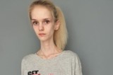 Anoreksja niszczy życie studentce z Opola. Trwa walka, by wyrwać ją ze szponów choroby