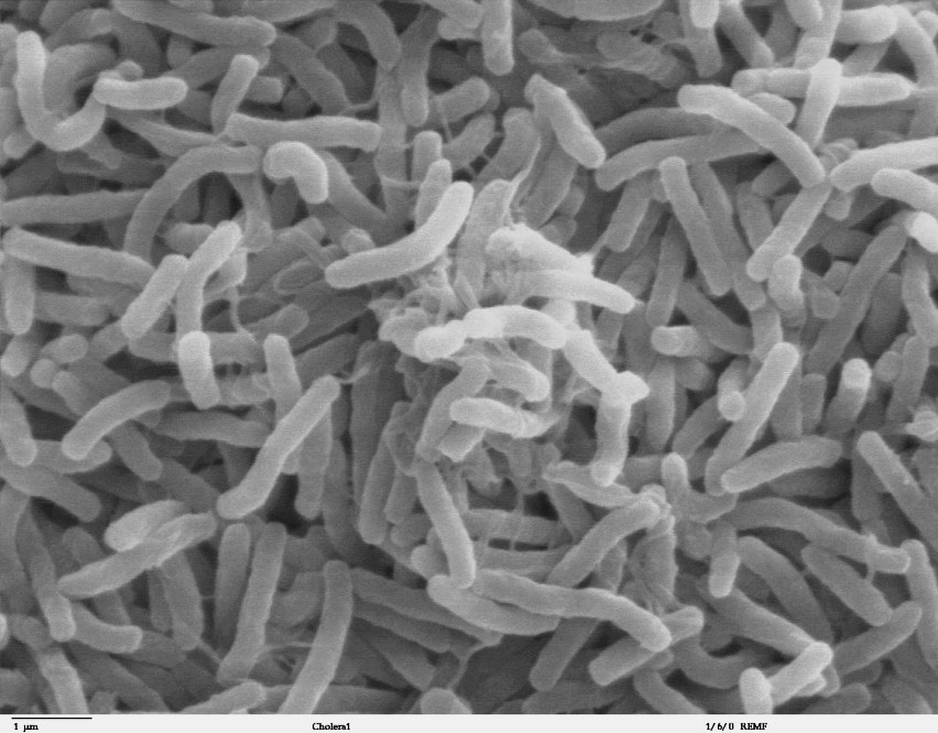 Bakterie cholery