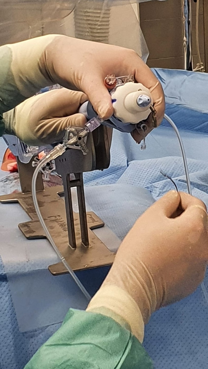 W Wejherowie w szpitalu przeprowadzono nowe zabiegi nieoperacyjnej naprawy zastawek serca 