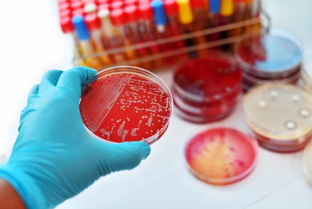 Bakteria Klebsiella pneumoniae z genami odporności na najsilniejsze antybiotyki jest obecna przede wszystkim w środowisku szpitalnym