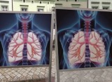 Zmiana koloru tablicy z imitacją płuc na ul. Szerokiej. Nie dopuśćmy do pogarszania się jakości powietrza