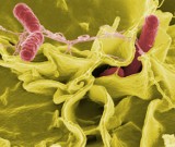 Salmonella w krakowskich przedszkolach i żłobkach. Sanepid potwierdził zatrucie u 89 maluchów