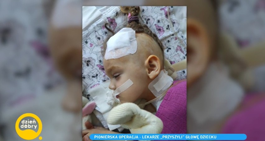 3-letnia Martynka ucierpiała w wypadku, w którym zginął jej tata, policjant z Oleśnicy. Jak się czuje?