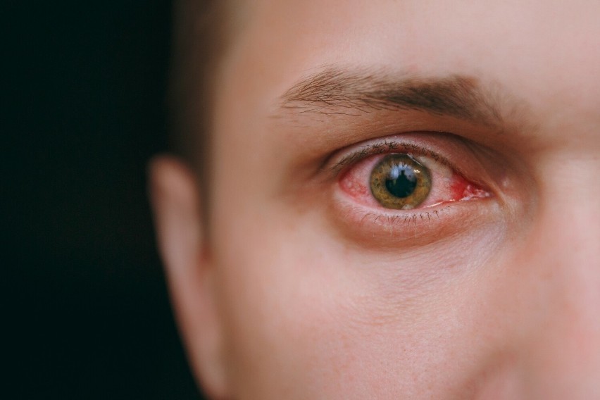 Mykotoksyny wytwarzane przez grzyby podrażniają także oczy i...