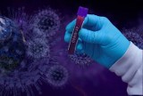 Koronawirus Elbląg. Dwa nowe przypadki zakażenia koronawirusem w Elblągu dotyczą osób, które przyjechały z zagranicy