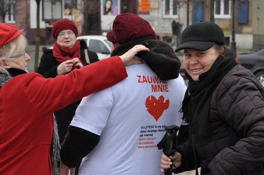 Dziś obchodzony jest także Światowy Dzień Chorych na Padaczkę