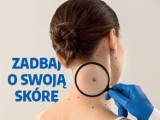Bezpłatne badanie skóry już 24 sierpnia w Młynarach k. Elbląga! 