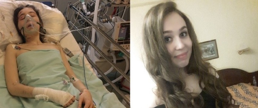 24-letnia Ola z Katowic cudem ocalała z koszmarnego wypadku pod Wrocławiem. Walczy o powrót do zdrowia. Potrzebuje pomocy